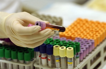 Nuovi anticoagulanti orali, l'Asl Bt è la prima azienda di Puglia ad impiegarli. Oggi la presentazione a Trani