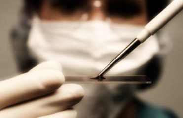 Epatite C, Mazzarano (Pd): «Le cure vanno estese a tutti»