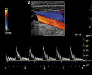 Nuove frontiere dell'Ecolordoppler, si conclude oggi il convegno nazionale all'ospedale di Trani