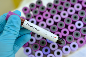 Coronavirus, tutti negativi i presunti casi segnalati in Puglia
