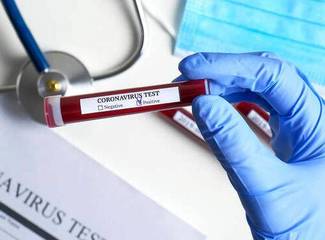 Coronavirus, risale la curva sia in Puglia (+66), sia nella Bat (+9)