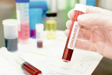 Bollettino Coronavirus, ieri in Puglia due positivi e nessun decesso