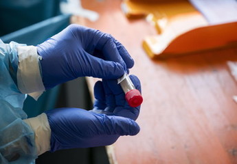 Coronavirus, oggi 7 casi in Puglia e nessuno nella Bat