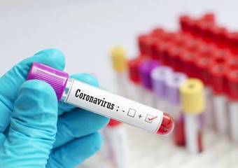 Bollettino Coronavirus, oggi undici nuovi casi in Puglia tra Bari, Foggia e Lecce