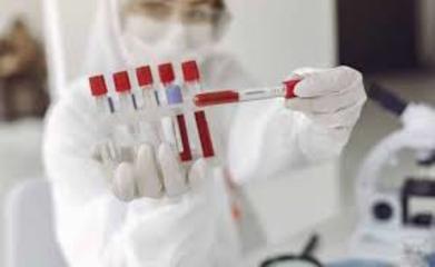 Bollettino Coronavirus, in Puglia 35 positivi su quasi 3mila test: nella Bat 4 casi