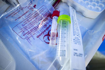 Coronavirus, oggi in Puglia 55 nuovi casi di cui 5 nella Bat