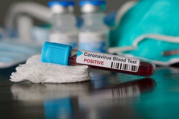 Coronavirus, oggi 75 casi in Puglia e due nella Bat. Nessun nuovo positivo a Trani, dove si registra anche la prima guarigione della seconda fase