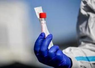 Bollettino Coronavirus, diminuiscono i contagi in Puglia: oggi 50 casi, di cui 3 nella Bat