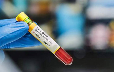 Bollettino Coronvirus, impennata dei positivi in Puglia: oggi 196 casi. Il presidente Emiliano: «Gli ospedali stanno reagendo bene, attendiamo il nuovo dpcm»