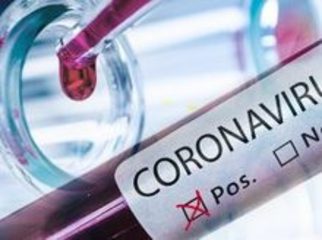 Bollettino Coronavirus: oggi 324 casi in Puglia, 38 nella Bat. Due i decessi in provincia di Bari