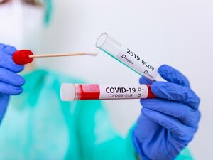 Bollettino Coronavirus: 1.332 casi positivi in Puglia, 106 nella Bat. 27 i decessi registrati