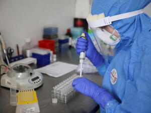 Bollettino Coronavirus, oggi in Puglia 1.478 casi positivi. 43 decessi